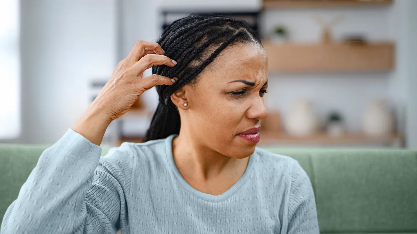 Scalp Eczema Management for Textured Hair Without Sacrificing Hair Health