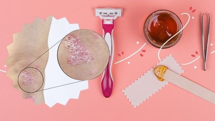 Phục hồi da nhạy cảm ửng đỏ bằng những thay đổi nhỏ trong quy trình chăm sóc