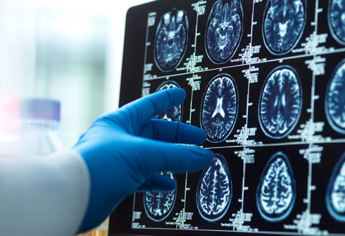 Why Patients Don’t Trust AI in Healthcare—and How to Fix It