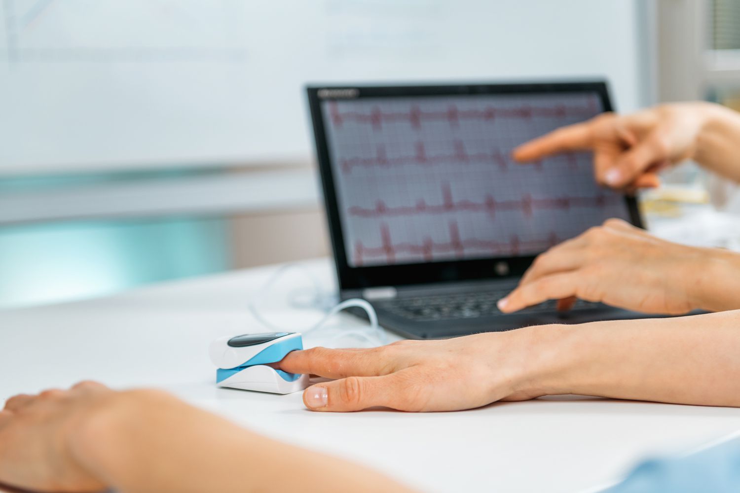 How Wearables Turn Heartbeats Into Early Anxiety Warnings