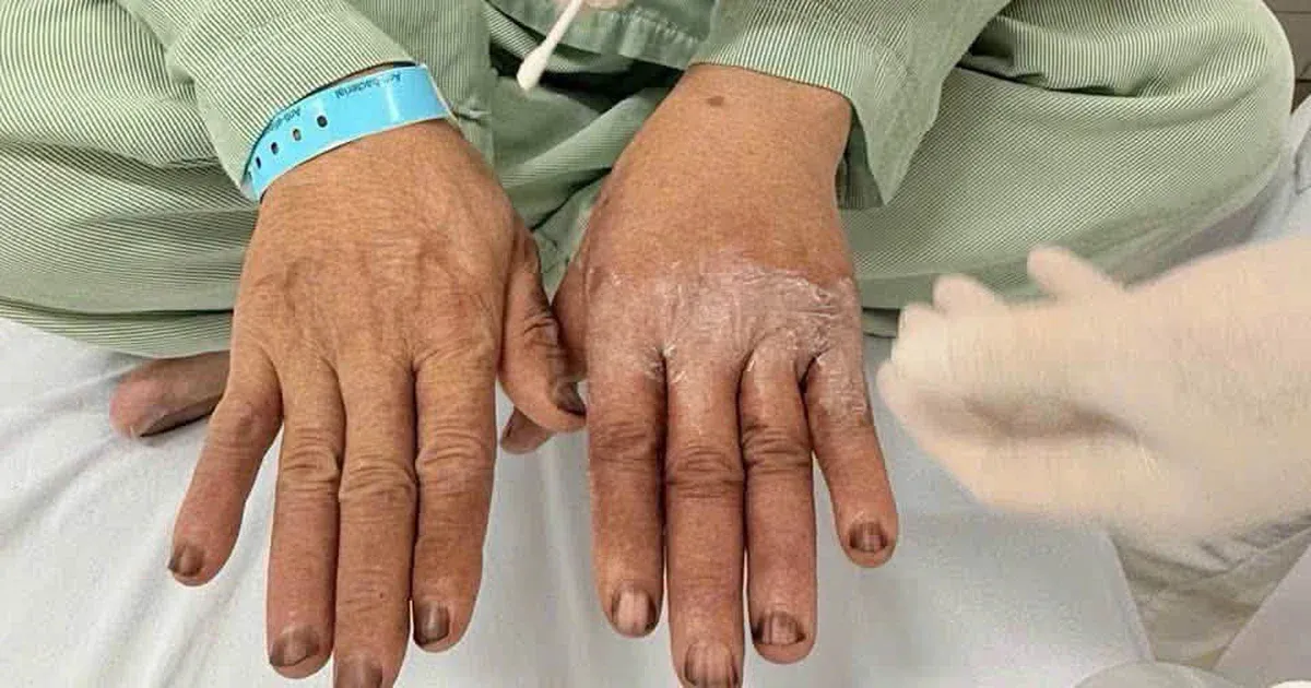 Nhuộm tóc tại nhà: Một đôi găng tay có thể cứu cả bàn tay