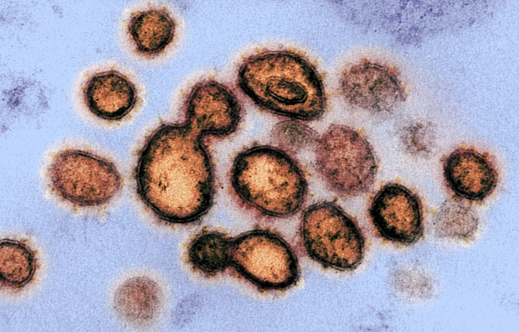 AI-Designed Viruses Expose a Dangerous Biosecurity Gap