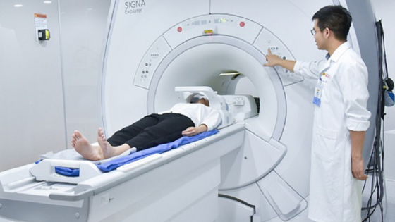 Chóng mặt, đau đầu có thể là dấu hiệu đột quỵ não