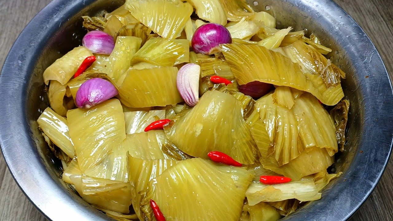 Dấu hiệu đột quỵ bị bỏ qua và cuộc chạy đua từng phút để cứu não
