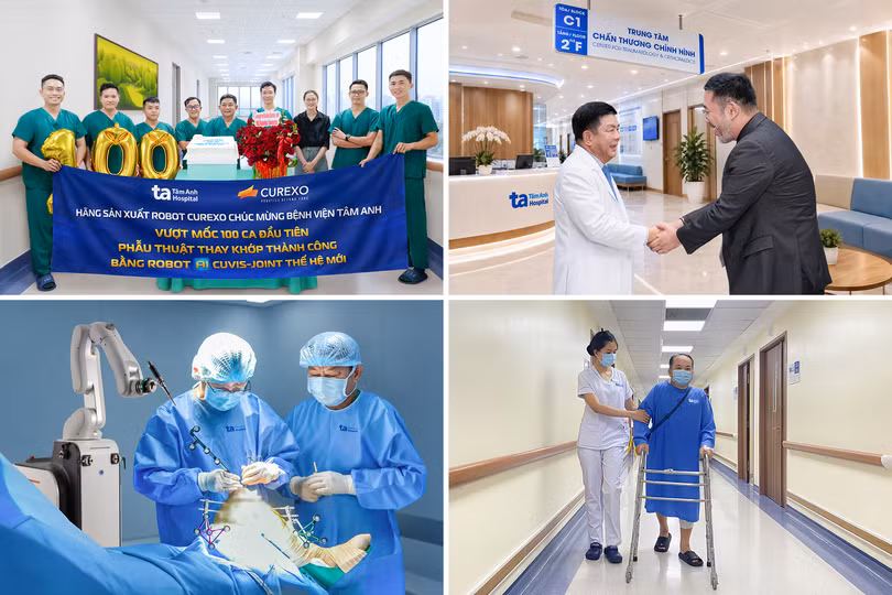 Robot AI CUVIS-Joint và bước nhảy mới của phẫu thuật thay khớp Việt Nam