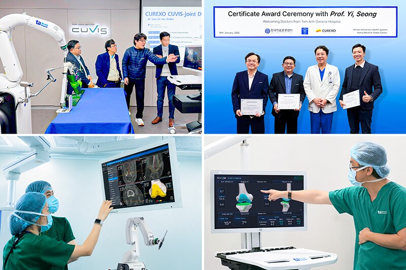 Robot AI CUVIS-Joint và bước ngoặt trong phẫu thuật thay khớp khó