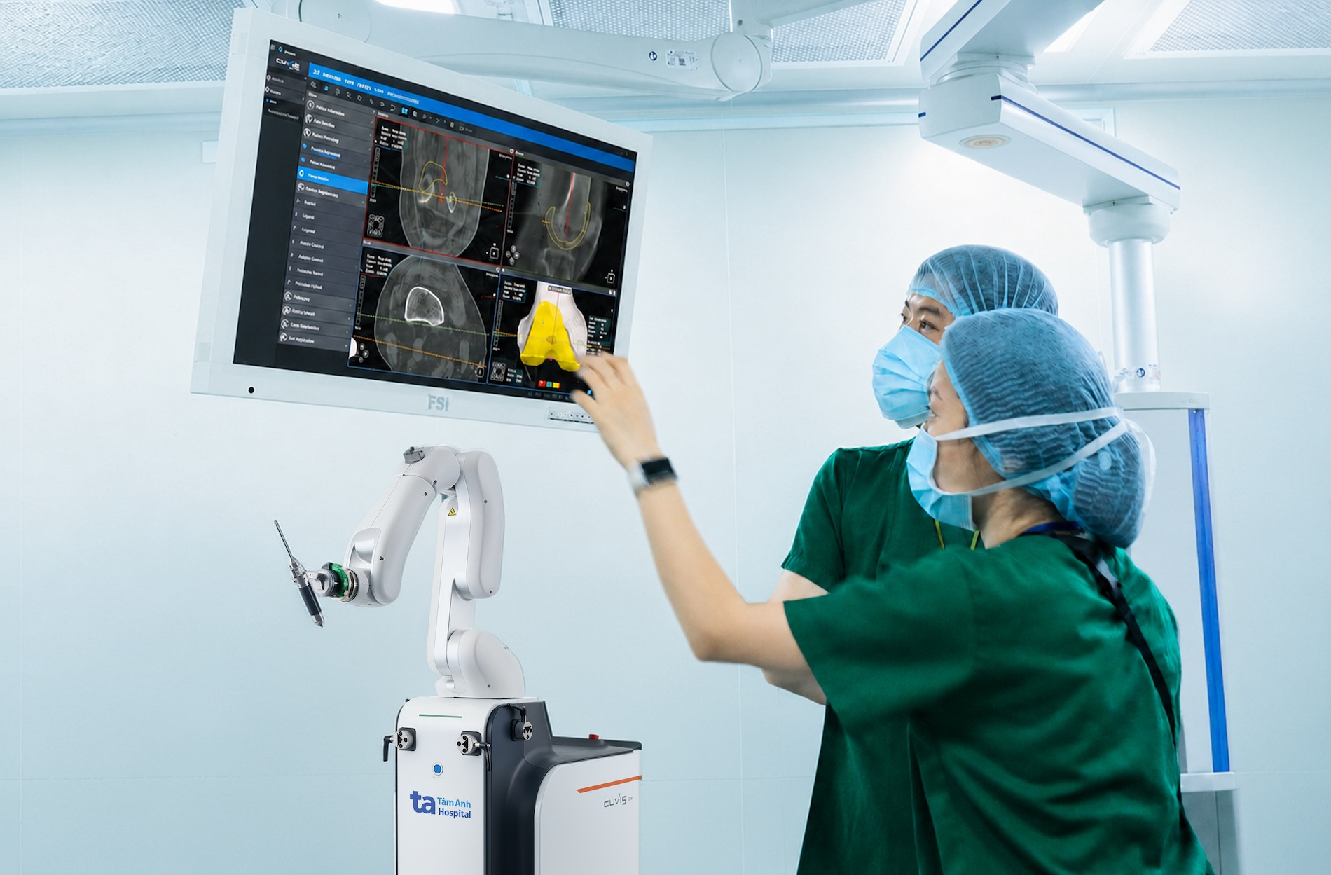 Vượt mốc 100 ca thay khớp khó: “siêu robot” AI CUVIS-Joint đang tạo chuẩn mới cho phẫu thuật