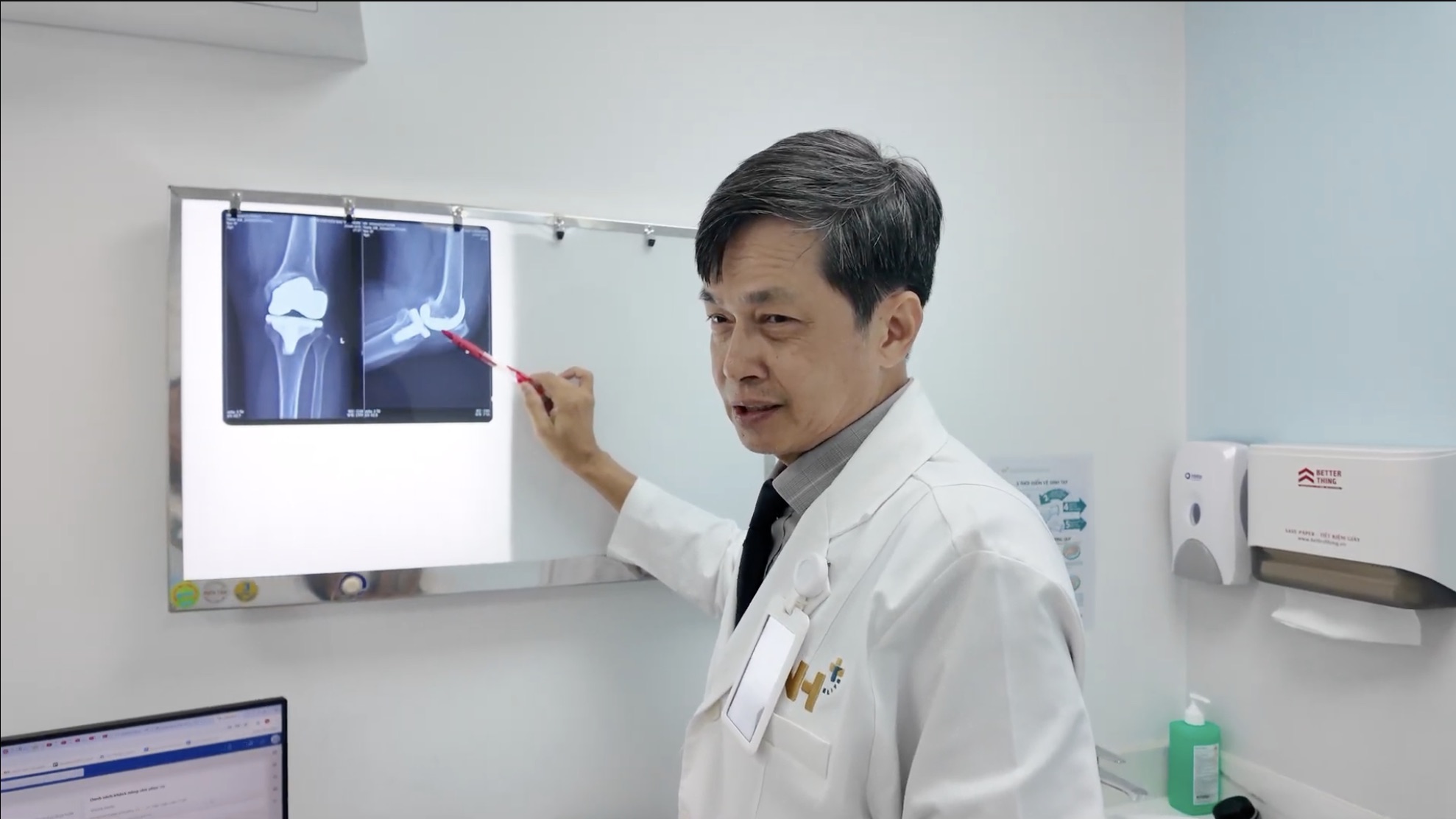 Thoái hóa khớp ở tuổi 30-40: Nhận diện sớm và luyện tập phòng ngừa