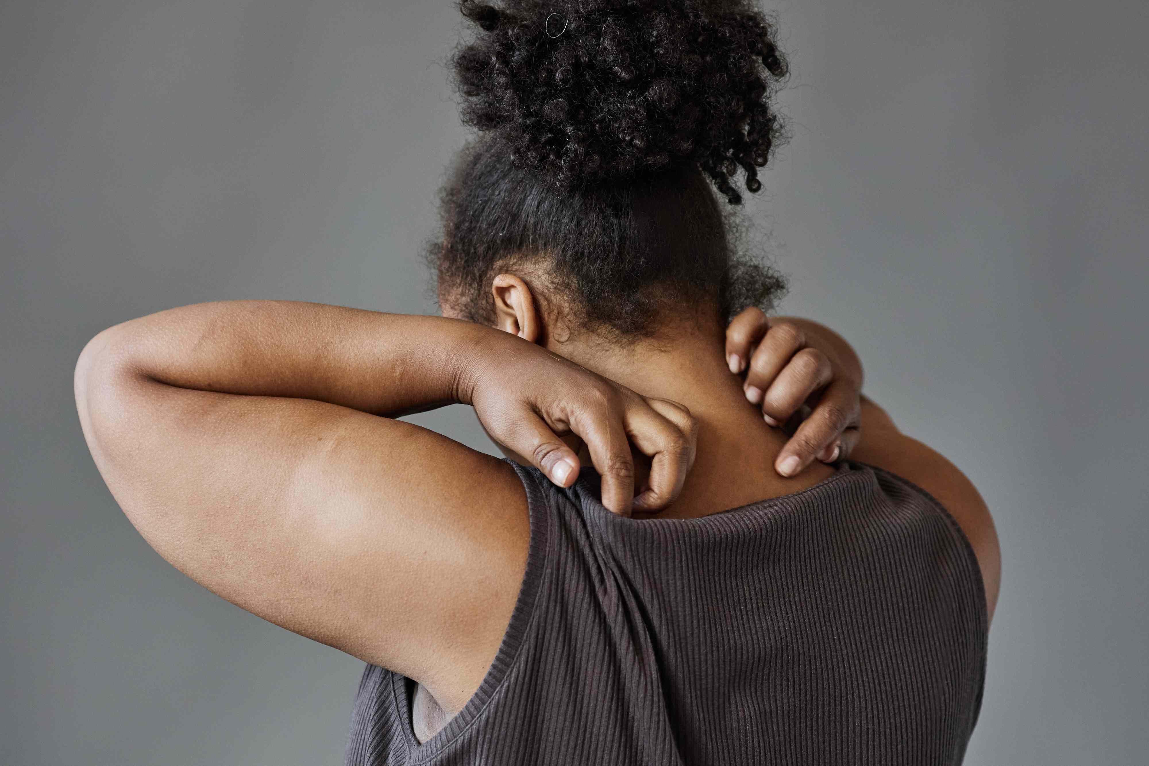 Scalp Eczema Management for Textured Hair Without Sacrificing Hair Health