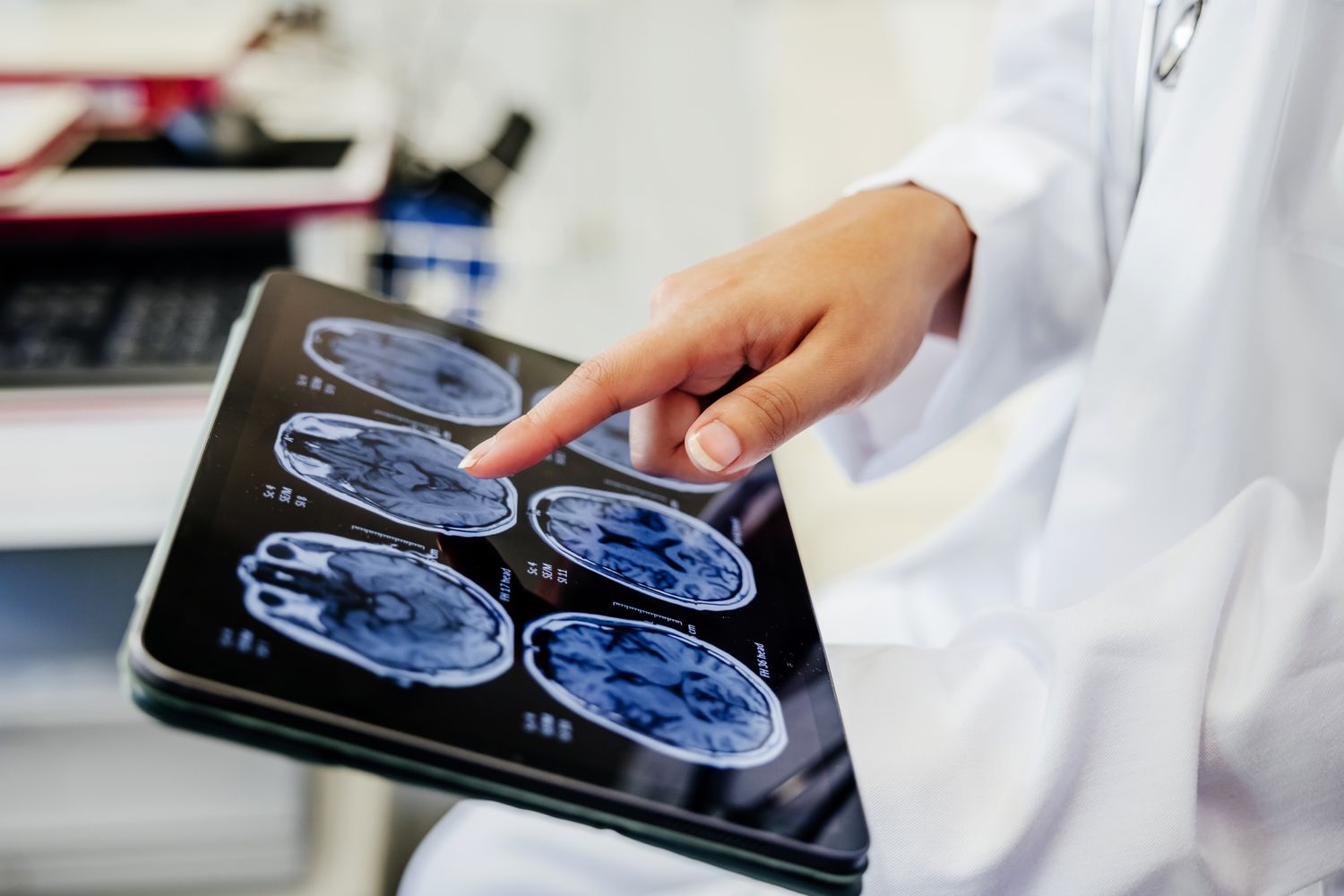 How Blood Sugar Control May Protect Your Brain From Accelerated Aging