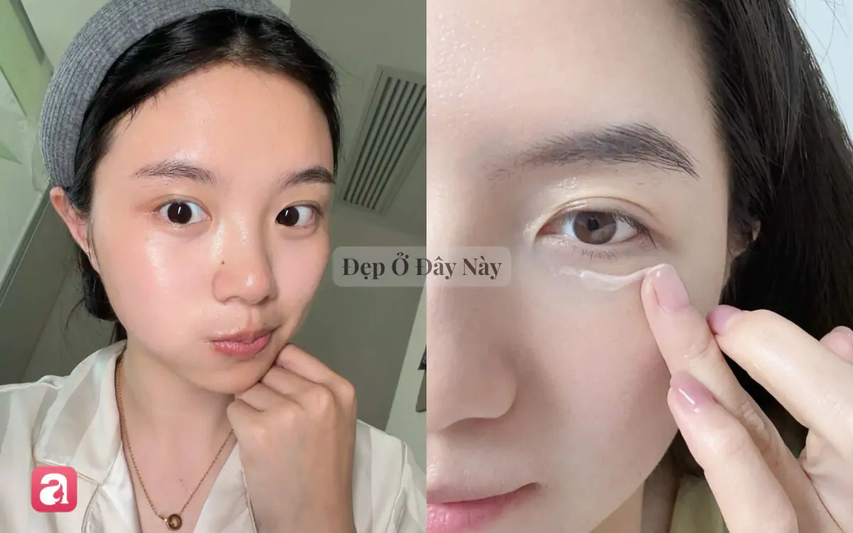 6 kem mắt bình dân được bác sĩ da liễu khuyến cáo