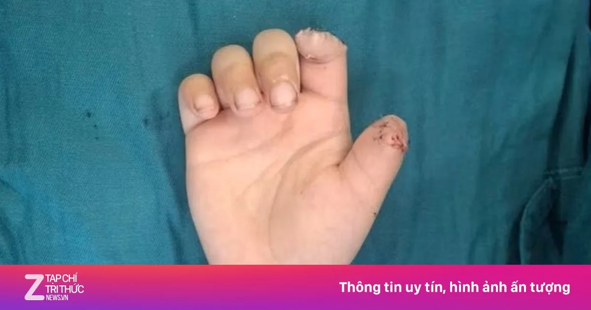 Những ca phẫu thuật cấp cứu kỳ diệu cứu sống trẻ em