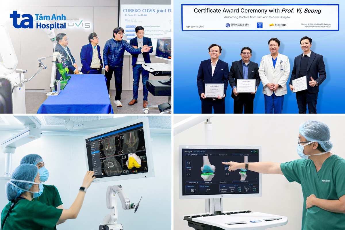 Bệnh viện Việt Nam vượt mốc 100 ca thay khớp khó bằng robot AI CUVIS-Joint