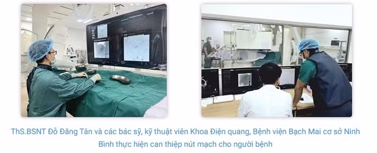 Kỹ thuật TACE và thu nhỏ khối u: Hai bước tiến trong điều trị ung thư gan