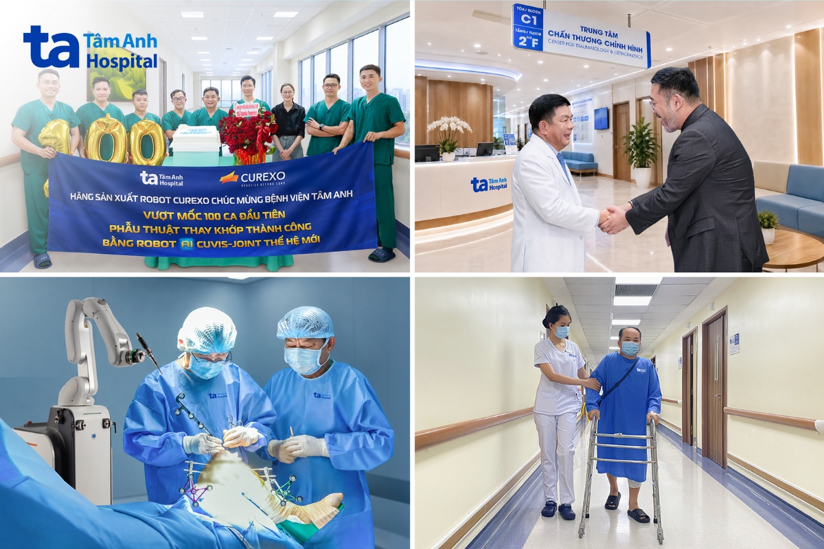 Bệnh viện Việt Nam vượt mốc 100 ca thay khớp khó bằng robot AI CUVIS-Joint