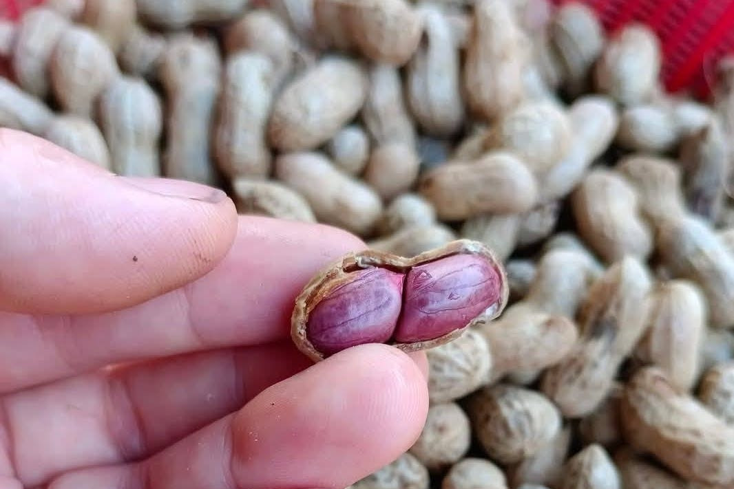 6 thực phẩm nên ăn và 5 thực phẩm tránh cho người mỡ máu cao