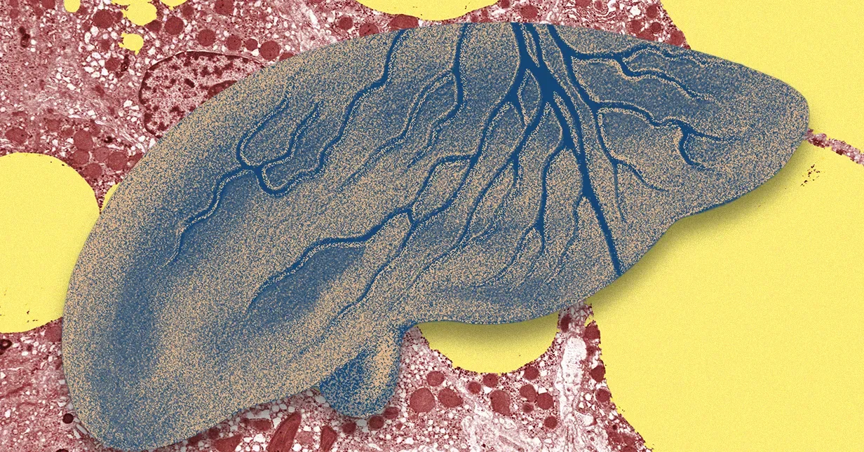 AI Fatty Liver Detection Is Remarkably Accurate—but Awkwardly Ahead of Medicine