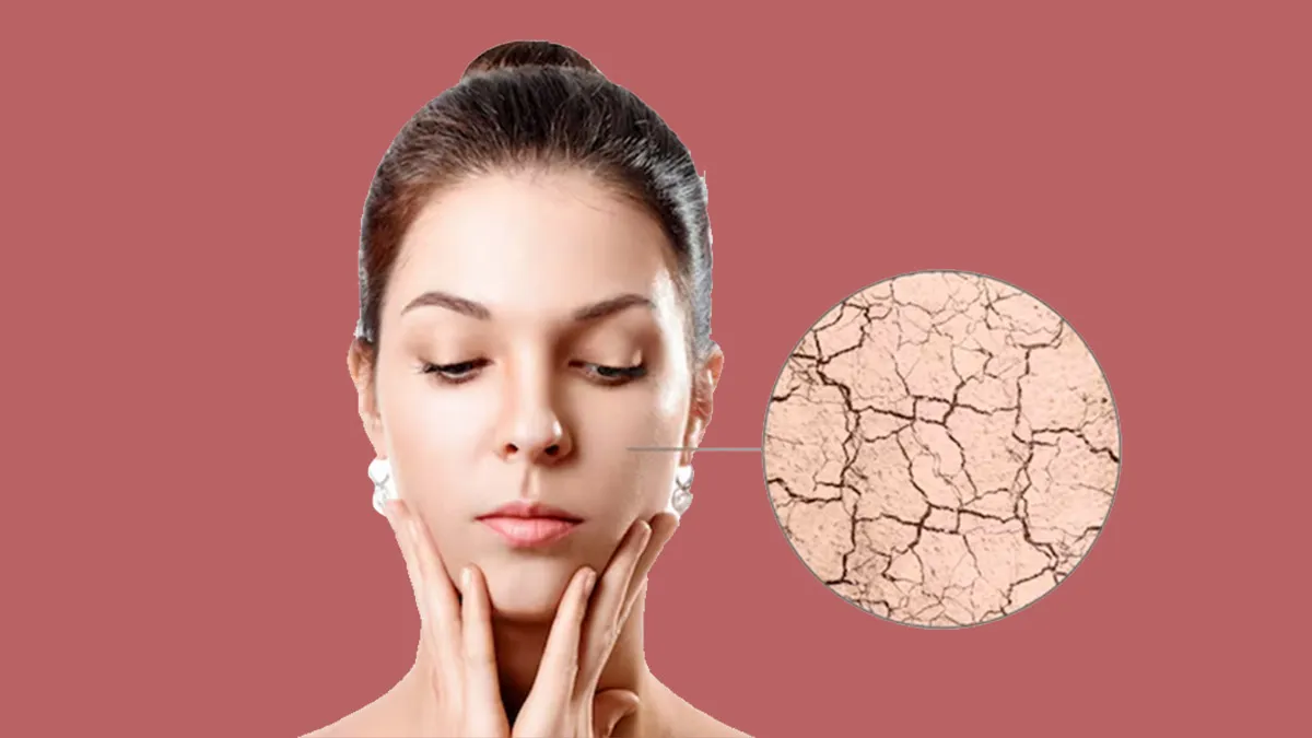 Why Oily Skin Still Needs Sunscreen (And How to Choose It)