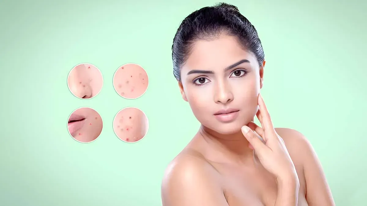 6 Face Wash Ingredients That Might Be Fueling Your Breakouts