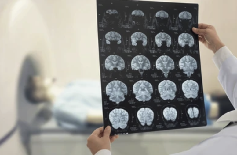 AI phân tích ảnh y tế: Tăng tốc chẩn đoán từ phòng lab đến hiếm bệnh