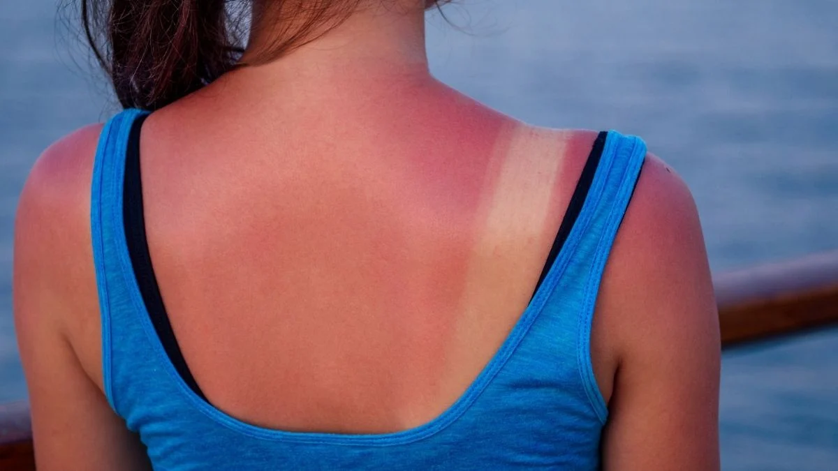 Does Sunscreen Prevent Skin Cancer? What Massive Studies Reveal