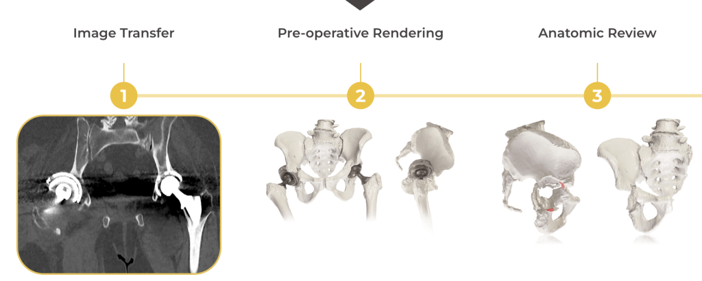 Từ mô hình ung thư đến cấy ghép lồng ngực: In 3D đang tái định nghĩa phẫu thuật tái tạo