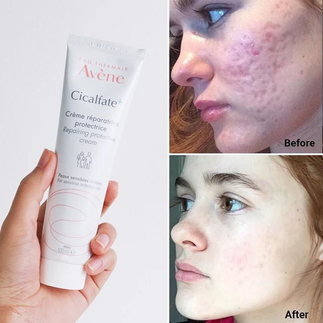 Produk Skincare Murah Bawah £20 Dengan Formula Dermatologi Terbukti