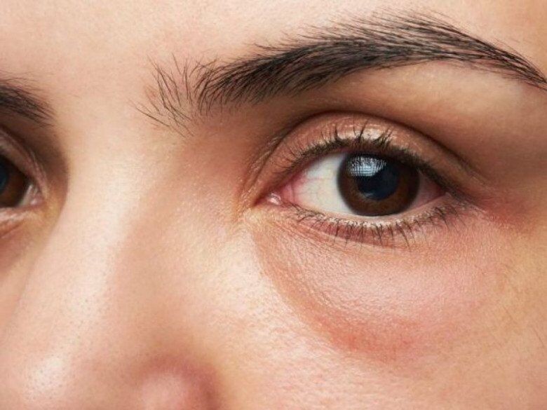 Sau tuổi 30: Ăn uống và sinh hoạt thế nào để da khỏe thực sự?