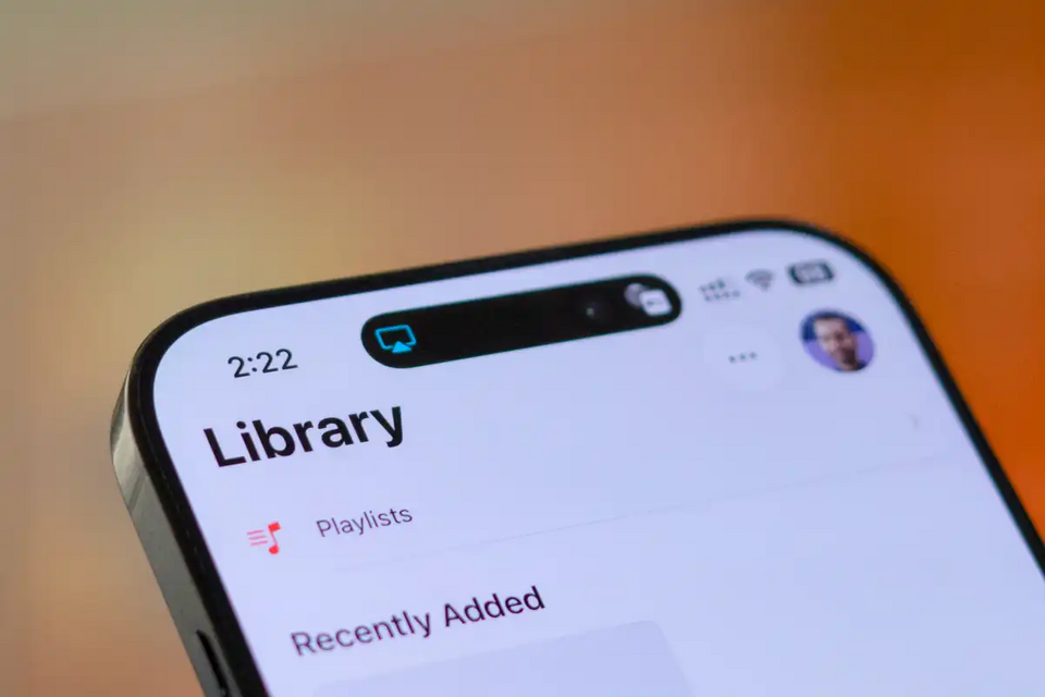iPhone 18 Pro: Nâng cấp lớn hay chỉ là bước tiến an toàn?