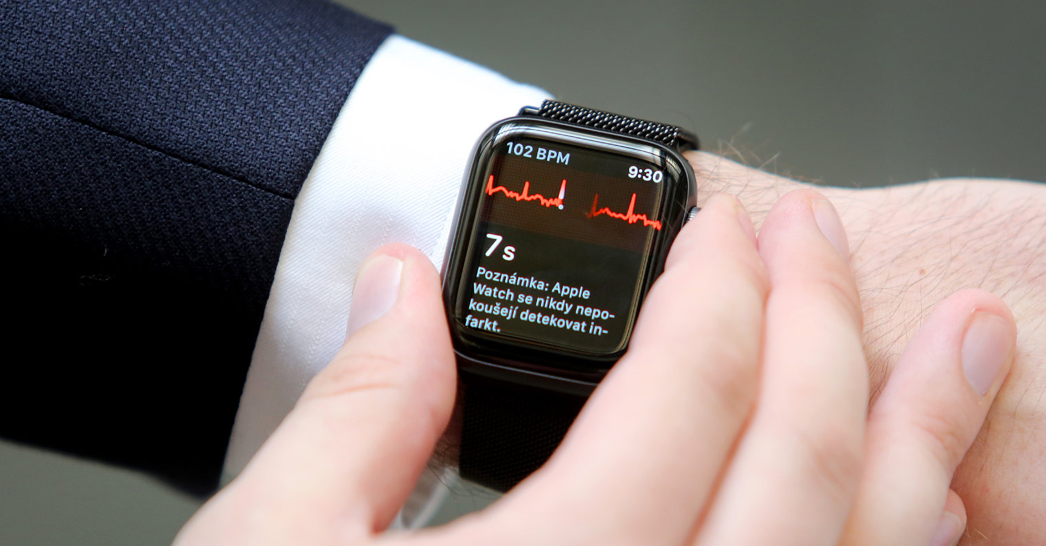 Smartwatch phát hiện bệnh tim nguy hiểm: Khi cổ tay trở thành hệ thống cảnh báo sớm