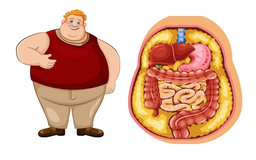 Mỡ nội tạng: kẻ giấu mặt đứng sau bệnh tim mạch