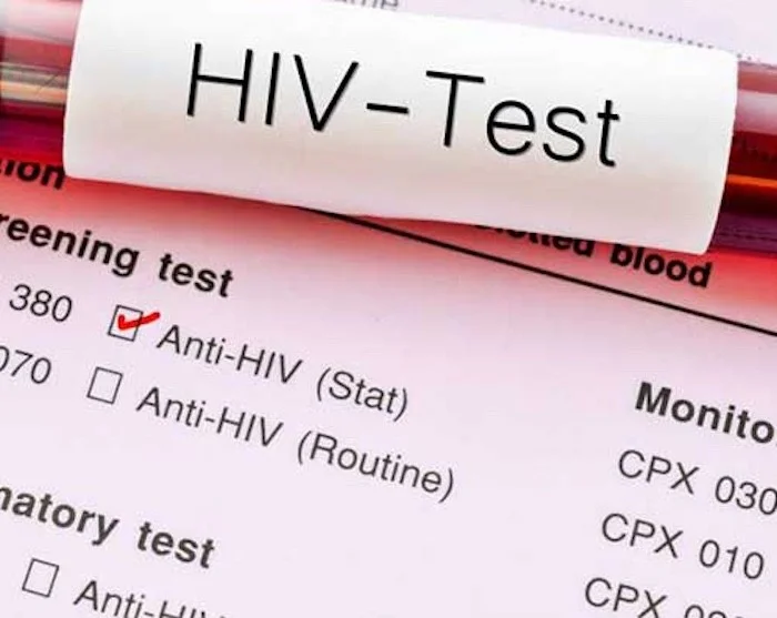 Nhiễm HIV ở phụ nữ trẻ chuẩn mực: Sự thật khiến nhiều người bất ngờ