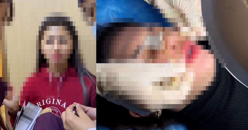 Những tai biến sau du lịch thẩm mỹ và trò quảng cáo mượn danh bác sĩ nổi tiếng