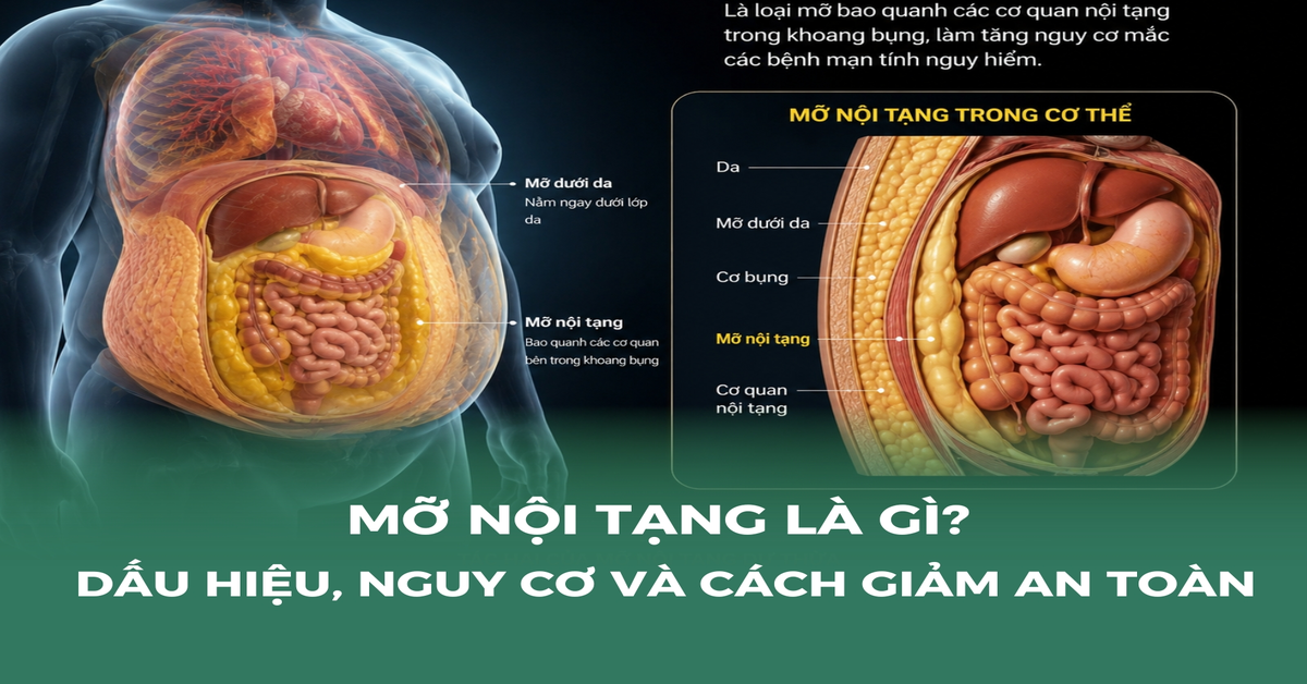 Mỡ nội tạng: kẻ giấu mặt đứng sau bệnh tim mạch