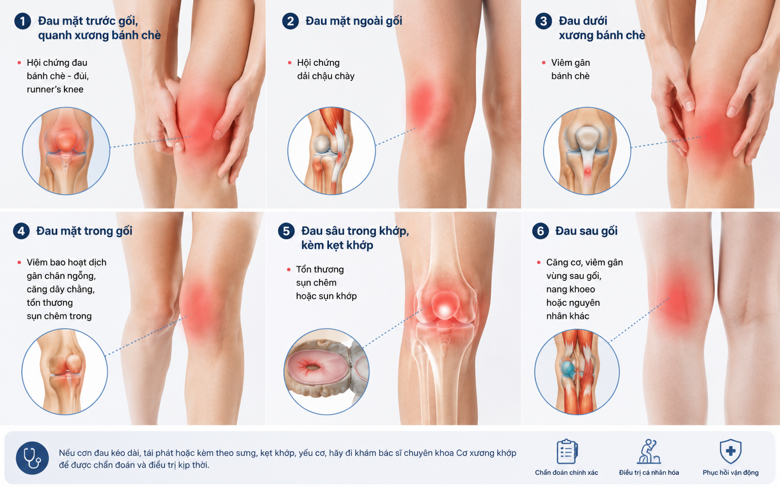 Đau khớp gối khi chạy bộ: Nhận biết nguyên nhân và phục hồi an toàn