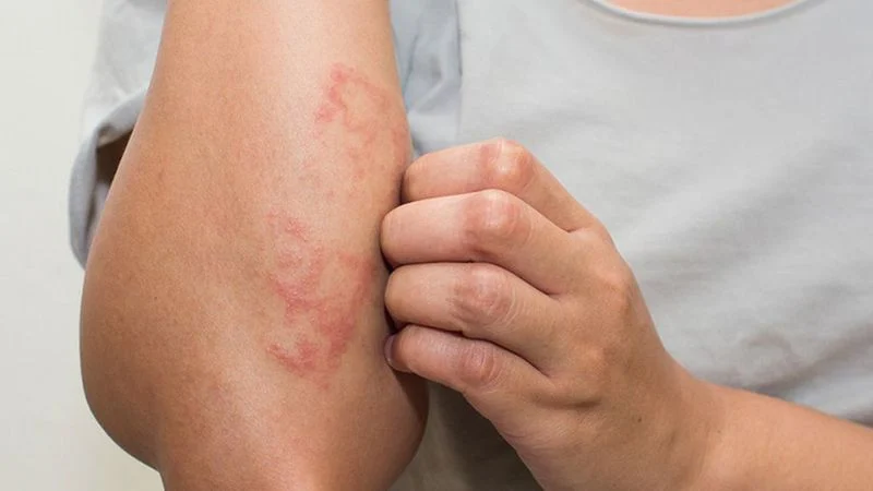 Những dấu hiệu âm thầm cơ thể đang cảnh báo suy thận trước khi quá muộn