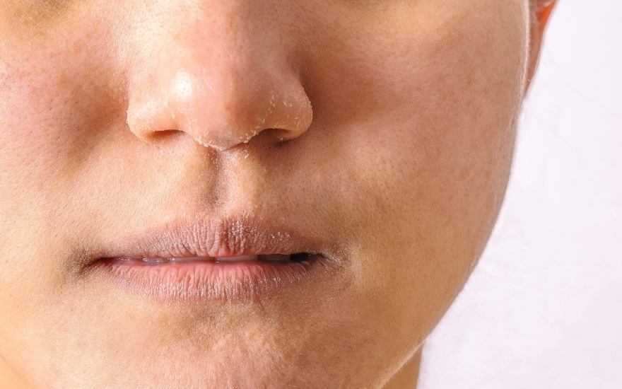 Cảnh báo mất nước mùa hè âm thầm ở người cao tuổi