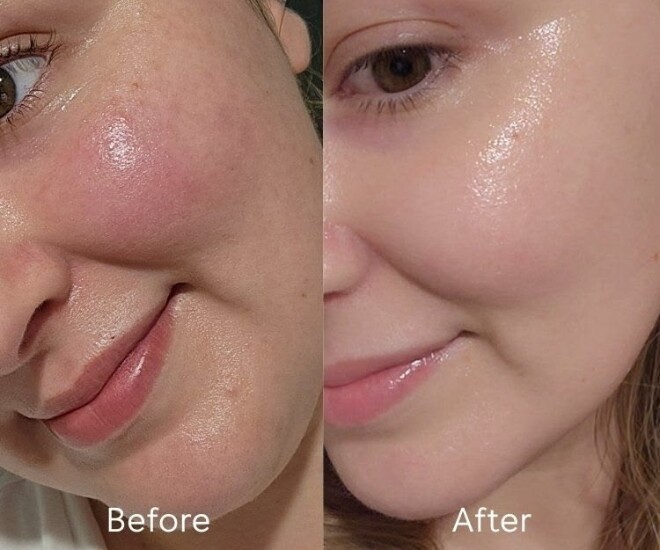 Những thực phẩm giàu collagen tự nhiên giúp da căng mịn từ bên trong