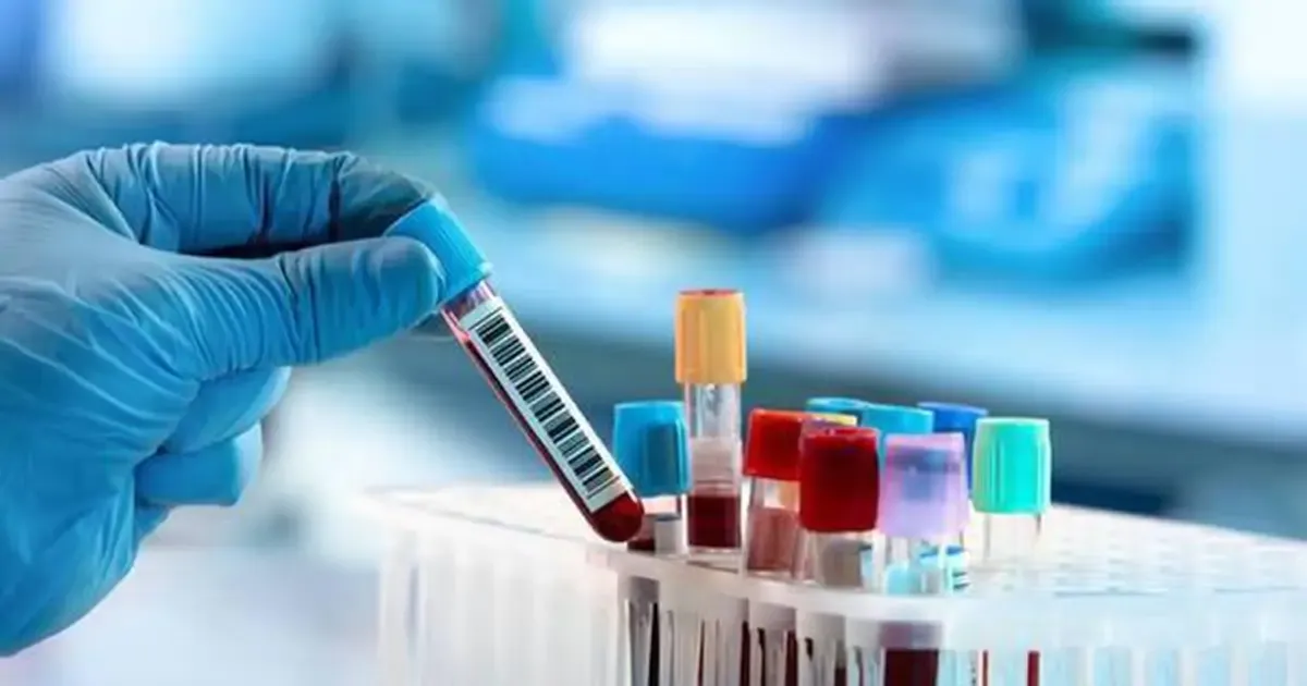 Bí mật trong máu người sống trăm tuổi và bài học cho tuổi thọ khỏe mạnh