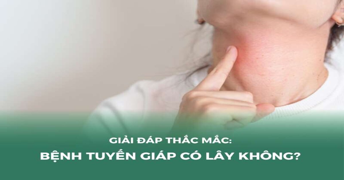 Ung thư tuyến giáp ở người trẻ: 3 dấu hiệu cảnh báo sớm