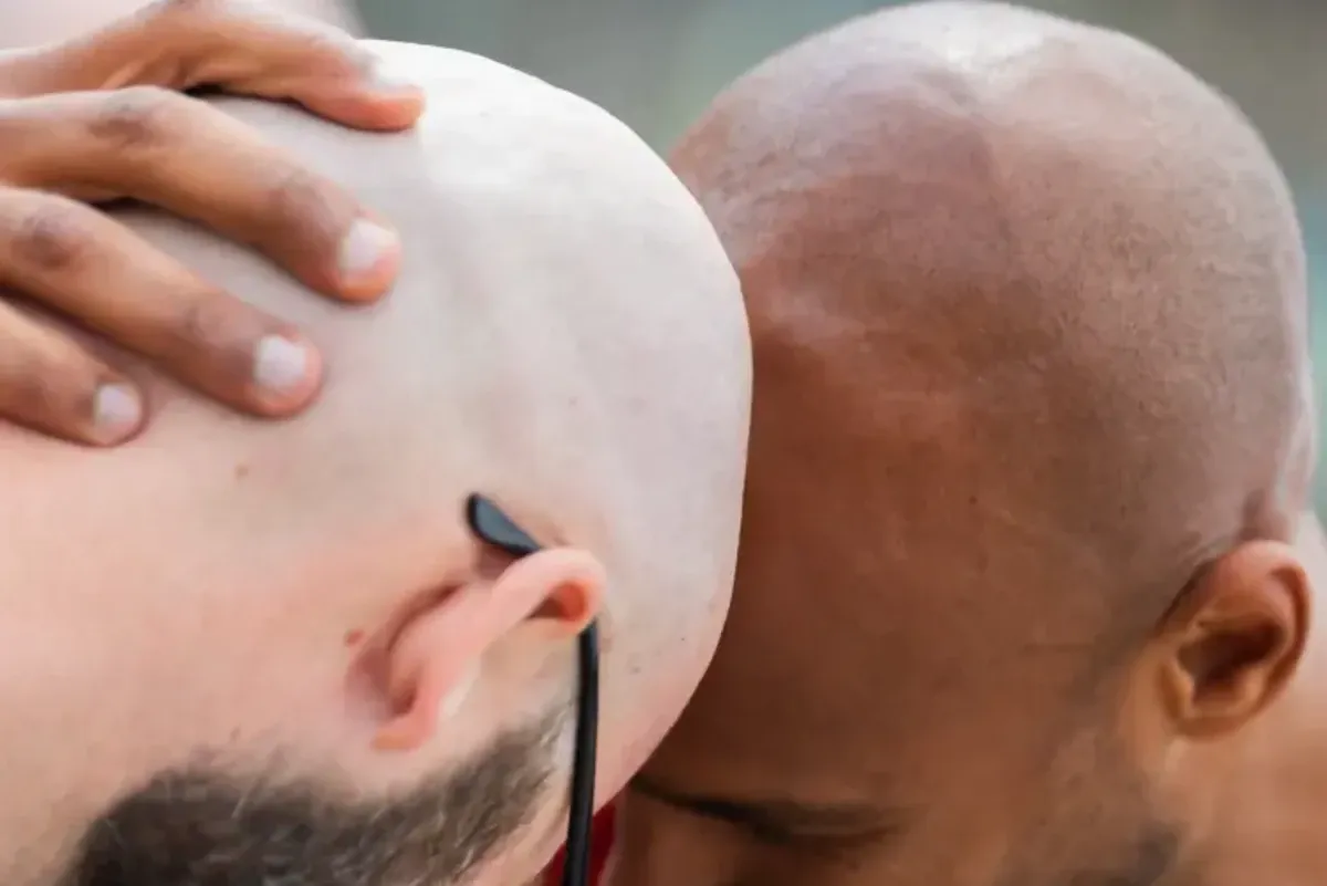 Từ thuốc viêm khớp đến công nghệ AI: cuộc chơi mới trong điều trị rụng tóc