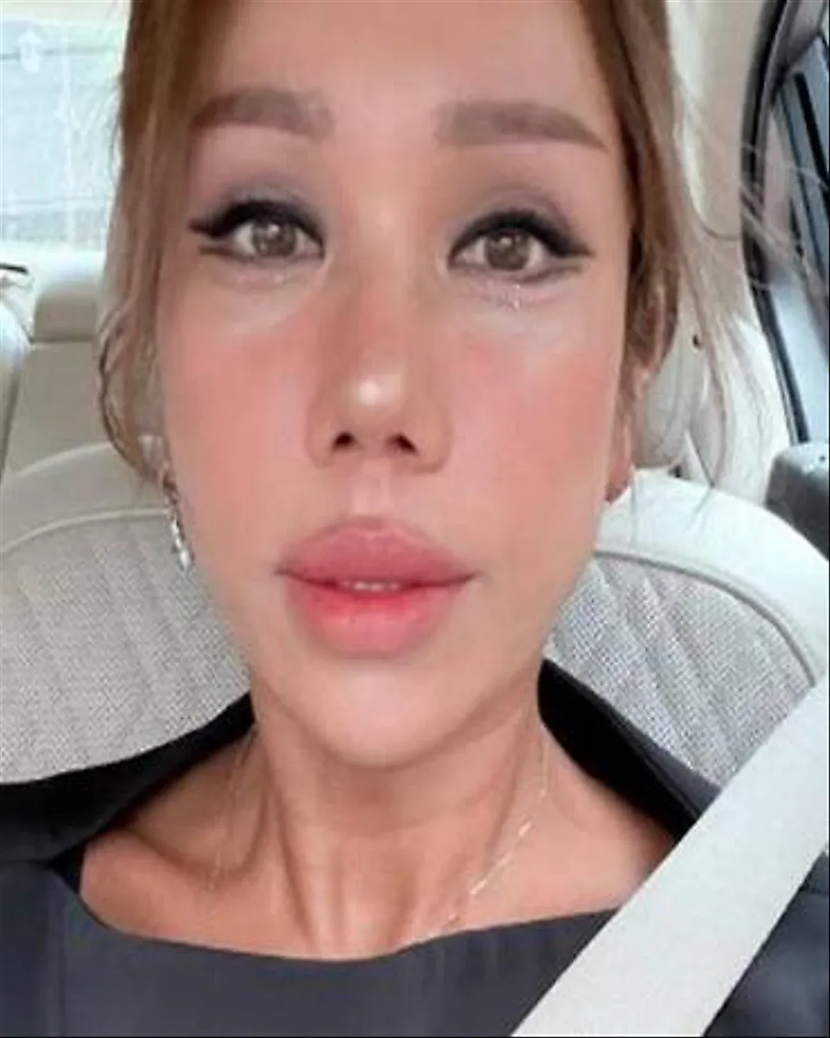 Những khoảnh khắc hài hước và thực tế của sao khi trải nghiệm thủ thuật thẩm mỹ