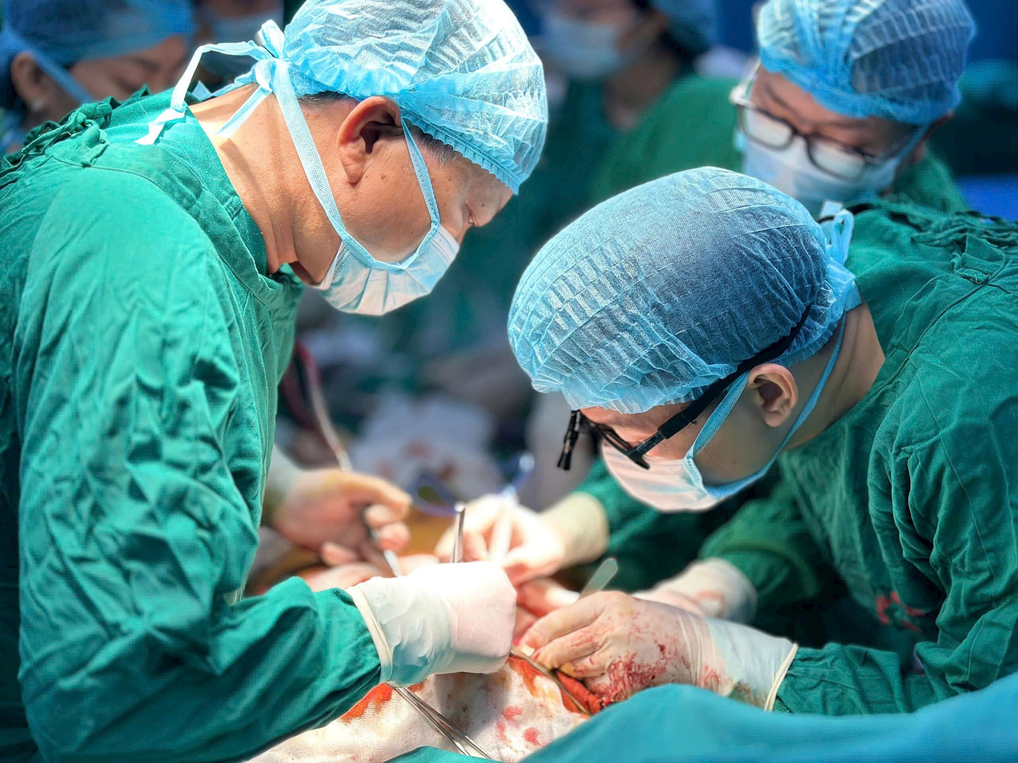 Ghép tim lần hai và chuỗi ghép phổi: bước ngoặt của y học ghép tạng
