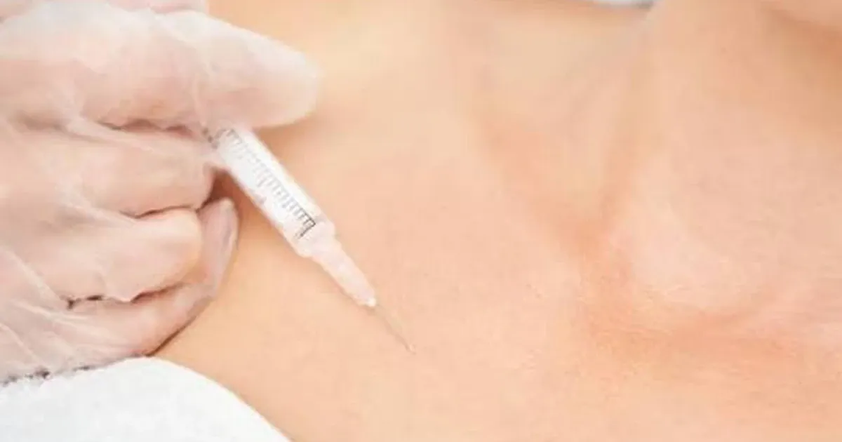 Áp xe vú sau tiêm filler ngực tại nhà: Cái giá của sự liều lĩnh