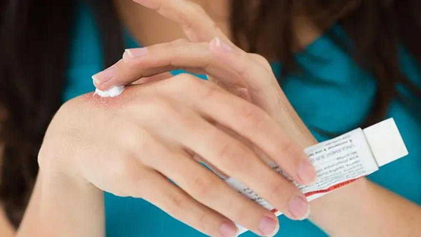 Vì sao chăm sóc da viêm tự nhiên đang chiếm ưu thế?