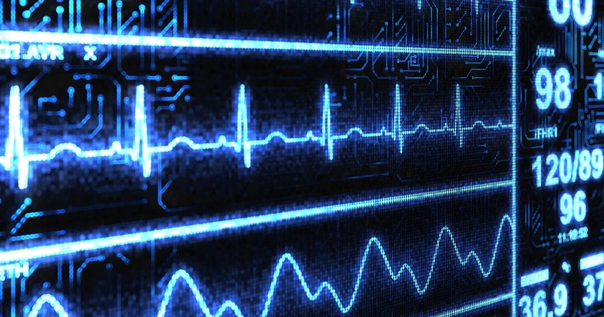 AI phát hiện bệnh tim trong 2 giây: Cú hích cho chẩn đoán nhanh ECG