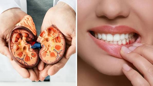 Bệnh nha chu có thể làm suy giảm chức năng thận?