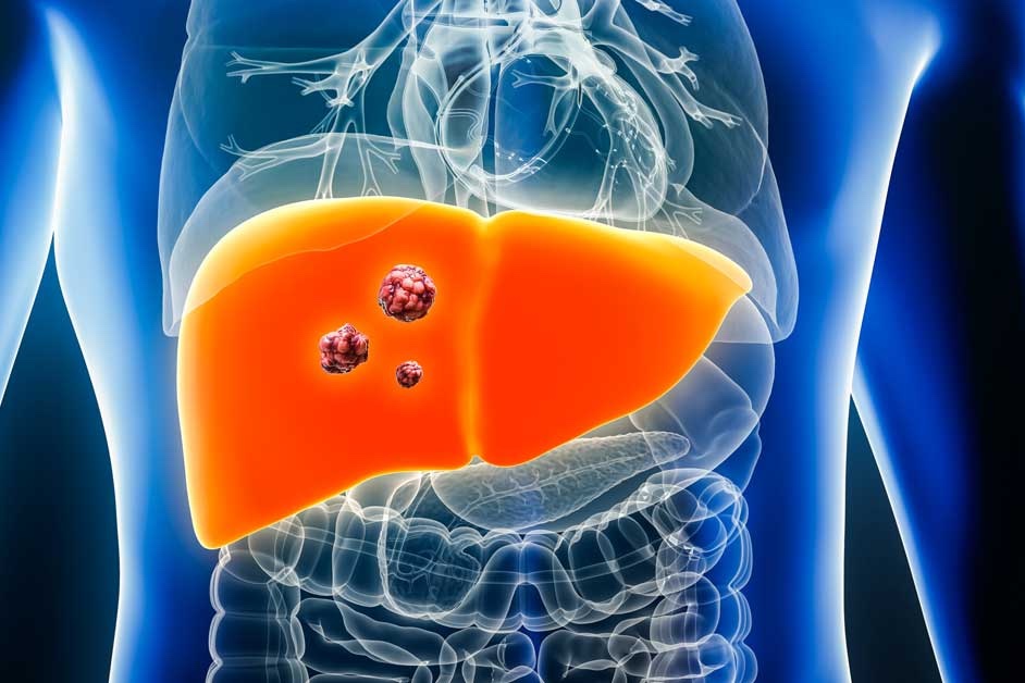 Cái chết của “thần đồng âm nhạc” và lời cảnh báo bệnh gan ở người trẻ