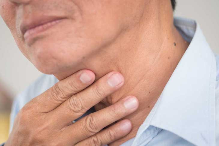 Khàn tiếng kéo dài hơn 3 tuần: Đừng để lỡ dấu hiệu ung thư thanh quản