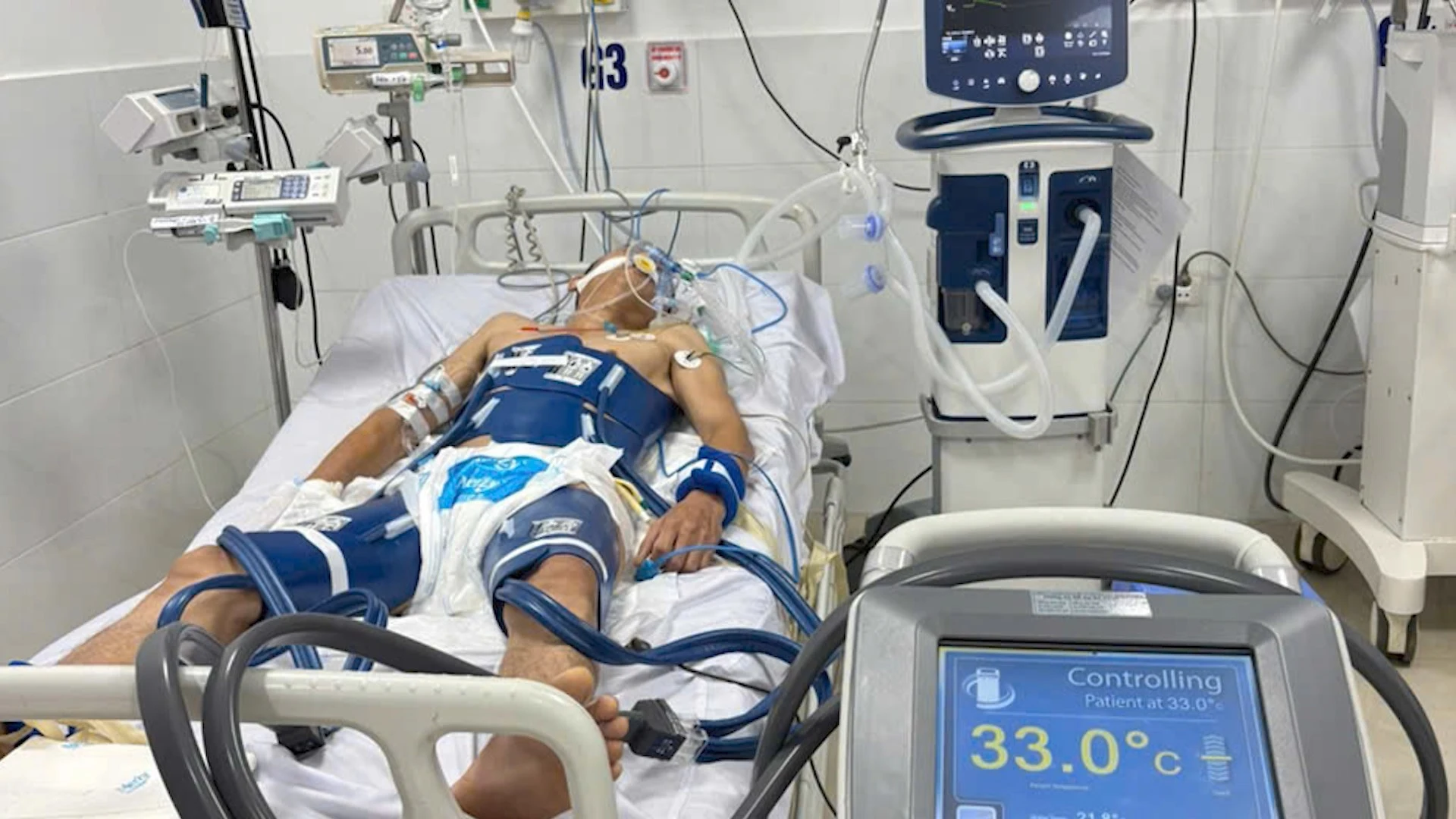 Ngừng tuần hoàn kéo dài vẫn có thể sống sót nếu kích hoạt đúng "thời gian vàng"